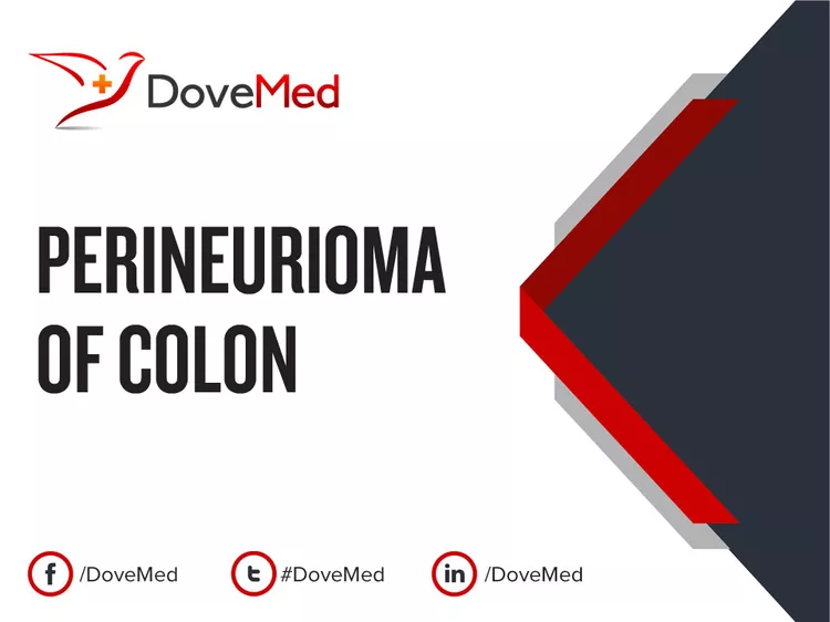 Perineurioma Of Colon - DoveMed