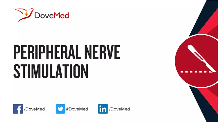 Peripheral Nerve Stimulation - DoveMed