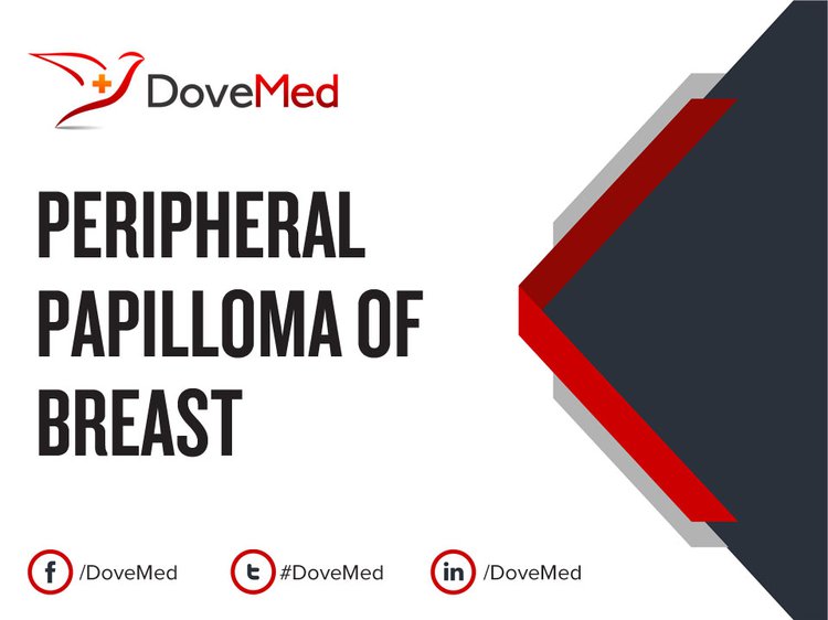 recurring breast papilloma risk Eros 0 guide