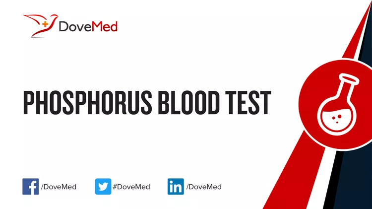 Phosphorus Blood Test - DoveMed