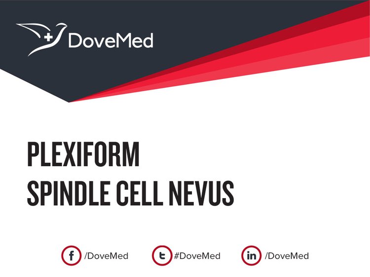 plexiform-spindle-cell-nevus