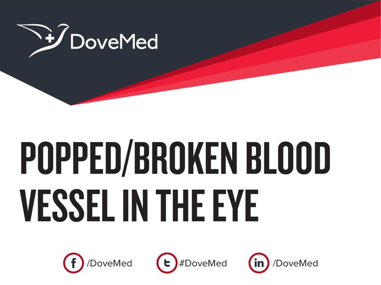 Popped/Broken Blood Vessel in the Eye