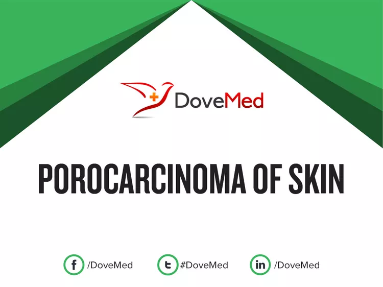 Porocarcinoma Of Skin - Dovemed