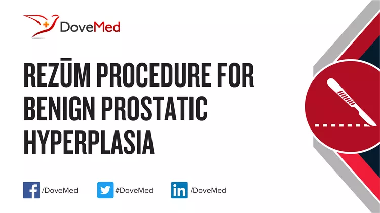 Rezum Procedure for Benign Prostatic Hyperplasia - DoveMed