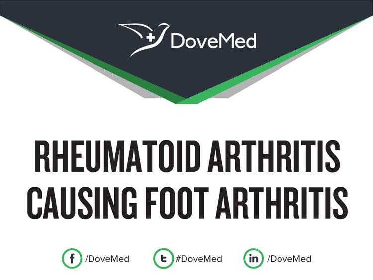 Rheumatoid Arthritis causing Foot Arthritis