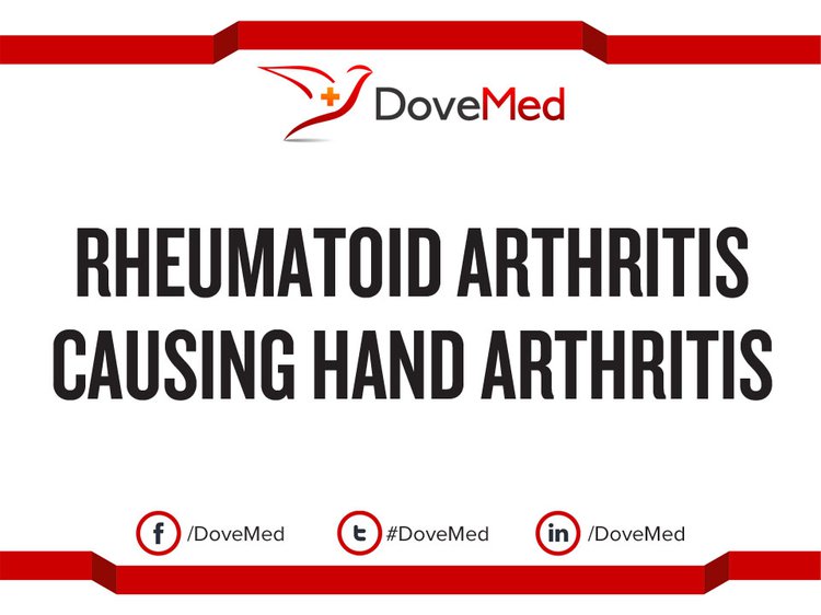 Rheumatoid Arthritis causing Hand Arthritis