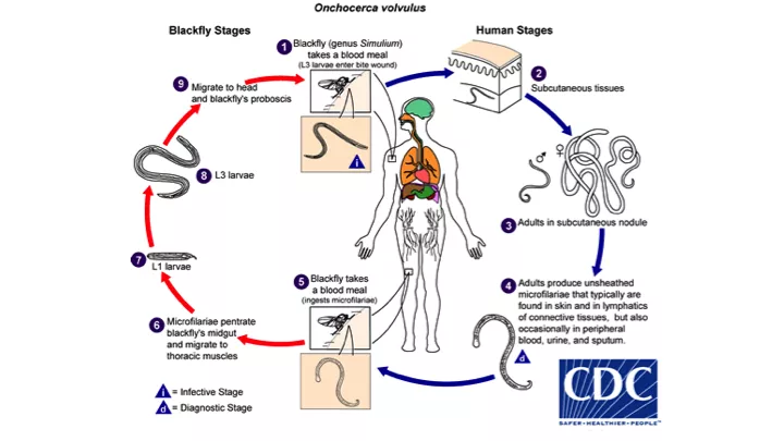 Facts about River Blindness - DoveMed