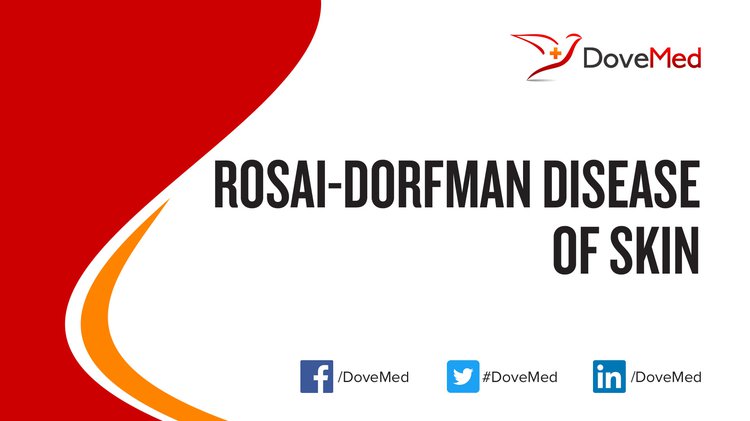 Rosai Dorfman Disease Of Skin