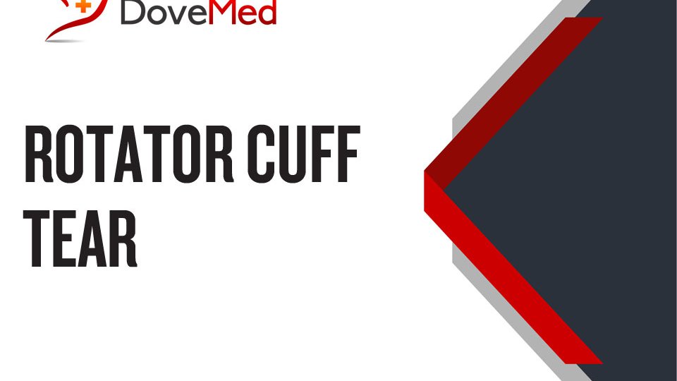 How well do you know Rotator Cuff Tear (RCT)?