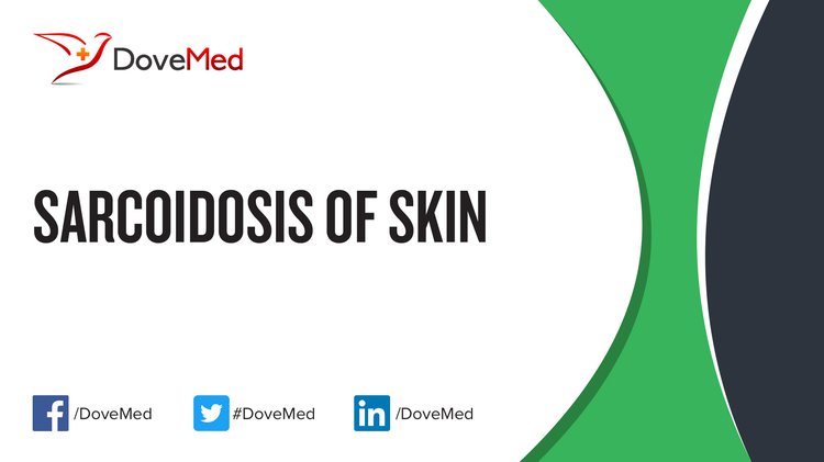 Sarcoidosis of Skin