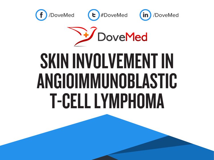 Skin Involvement in Angioimmunoblastic T-Cell Lymphoma