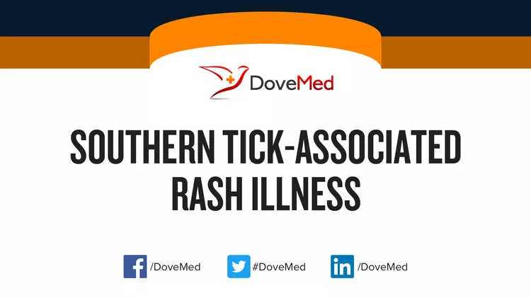 How Well Do You Know Southern Tick Associated Rash Illness Dovemed