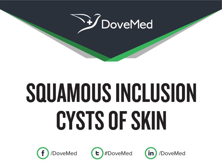 Squamous Inclusion Cysts of Skin