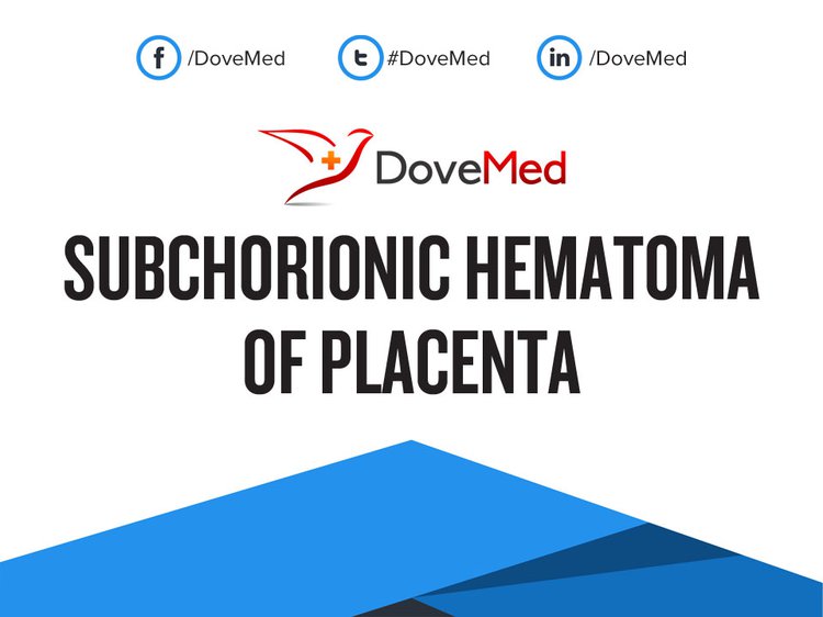 subchorionic-hematoma-of-placenta