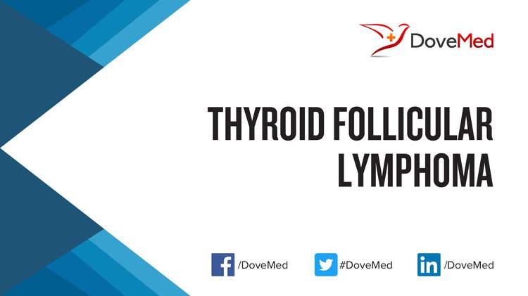 Thyroid Follicular Lymphoma