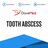 Tooth Abscess.