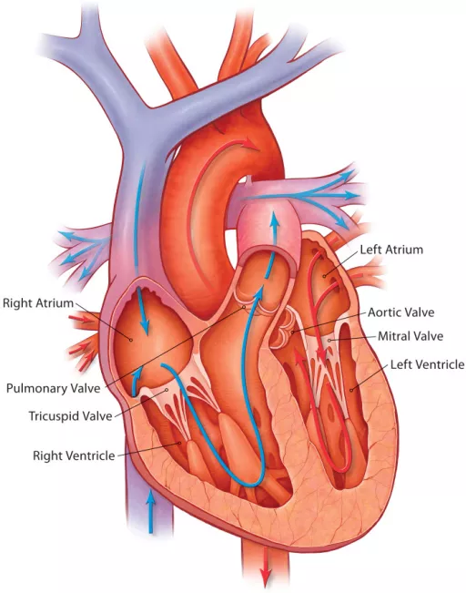 Transcatheter Aortic Valve Replacement - DoveMed