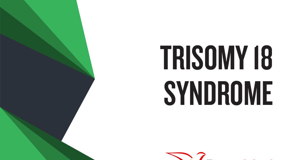How well do you know Trisomy 18 Syndrome