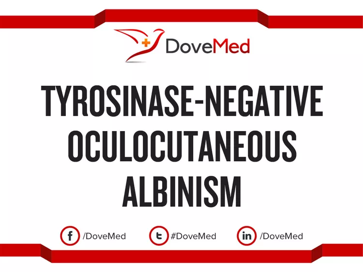 Tyrosinase-Negative Oculocutaneous Albinism - DoveMed