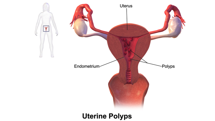 Prolapse of Uterus  Dairy Knowledge Portal