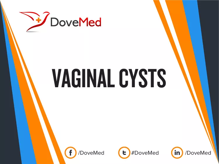 Vaginal Cysts Dovemed