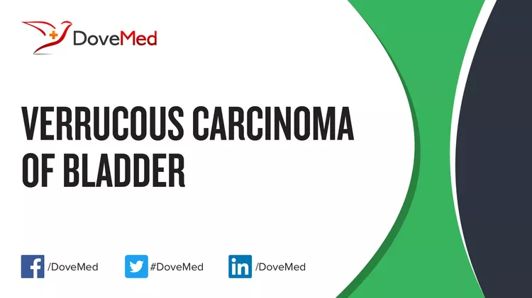 How well do you know Verrucous Carcinoma of Bladder? - DoveMed