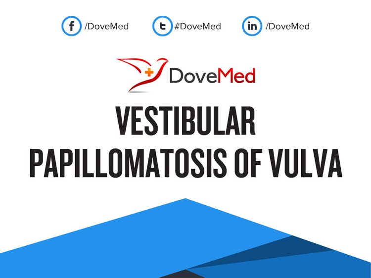 A HPV (humán papillomavírus) fertőzés tünetei, kezelése Vestibularis papillomatosis fáj