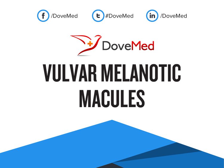 macula melanotica genital Atypical melanocytic nevus of the genital type. Irregular dots on the