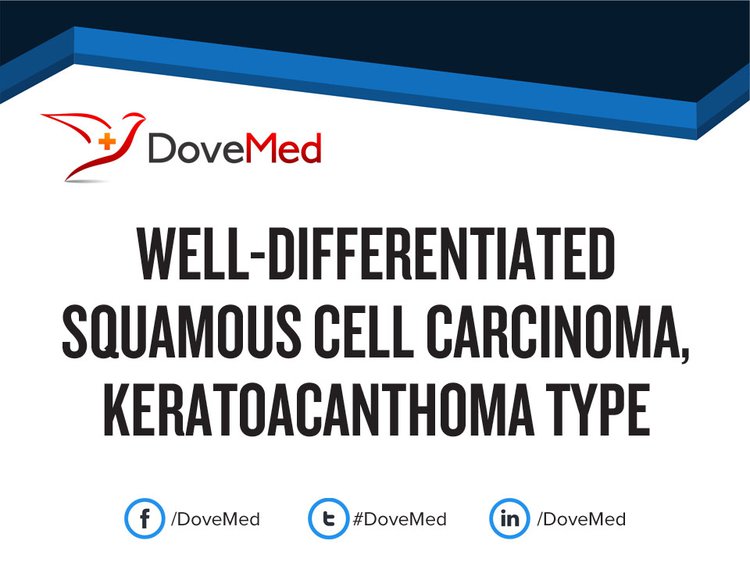 icd 10 code for keratoacanthoma squamous cell carcinoma