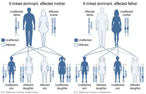 Familial Hypophosphatemia - DoveMed