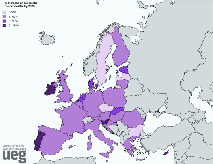 Pancreatic Cancer Set To Become Third Biggest Cancer Killer In EU Next Year