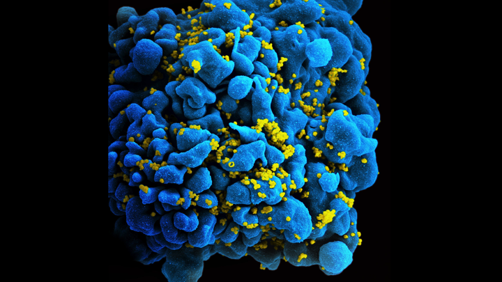 Human Immunodeficiency Virus Also Known As Hiv