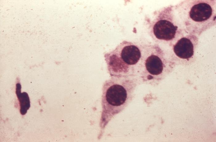 Chlamydia Testing 1940
