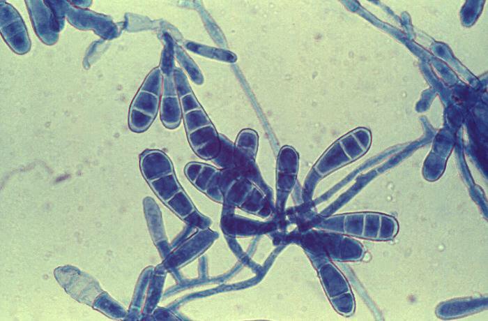 Tinea manuum contracted by laboratory personnel.