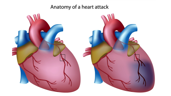 medical-treatment-may-prevent-alleviate-mitral-valve-damage-after-a