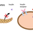 Illustration showing Insulin action in diabetes type 1.