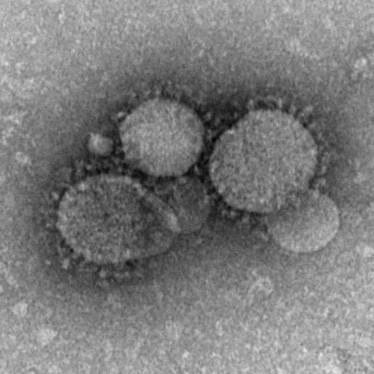 Middle East Respiratory Syndrome (MERS) - DoveMed