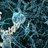 Illustration showing neurons with amyloid plaques in Alzheimer's disease.