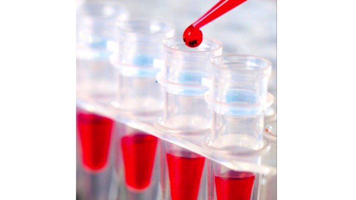 levetiracetam-blood-level-test