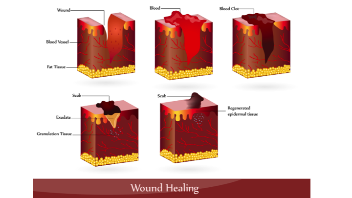 first-aid-for-puncture-wounds