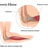 Tennis elbow - tear in the common extensor tendon of the arm.