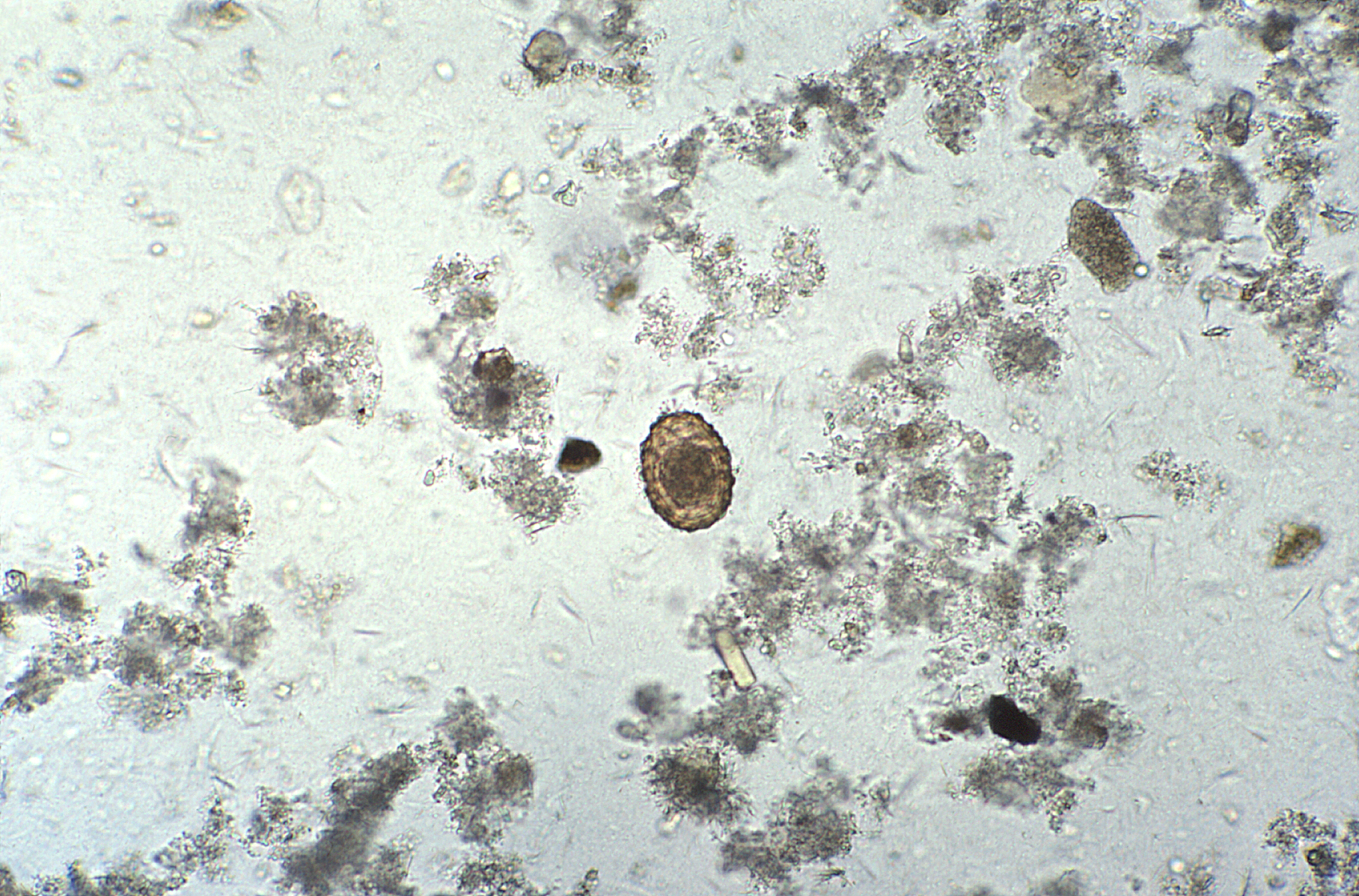 Растительная клетчатка непереваримая. Цисты лямблии микроскопия. Копрология кала микроскопия. Цисты лямблий микроскопия. Циста лямблии под микроскопом.