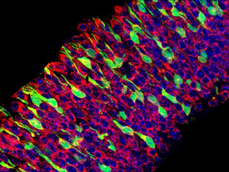 genetic-causes-of-small-head-size-share-common-mechanism