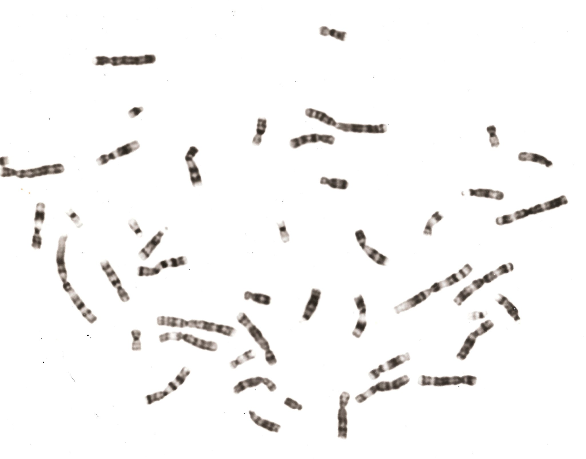 what-are-the-two-segments-of-a-chromosome-known-as