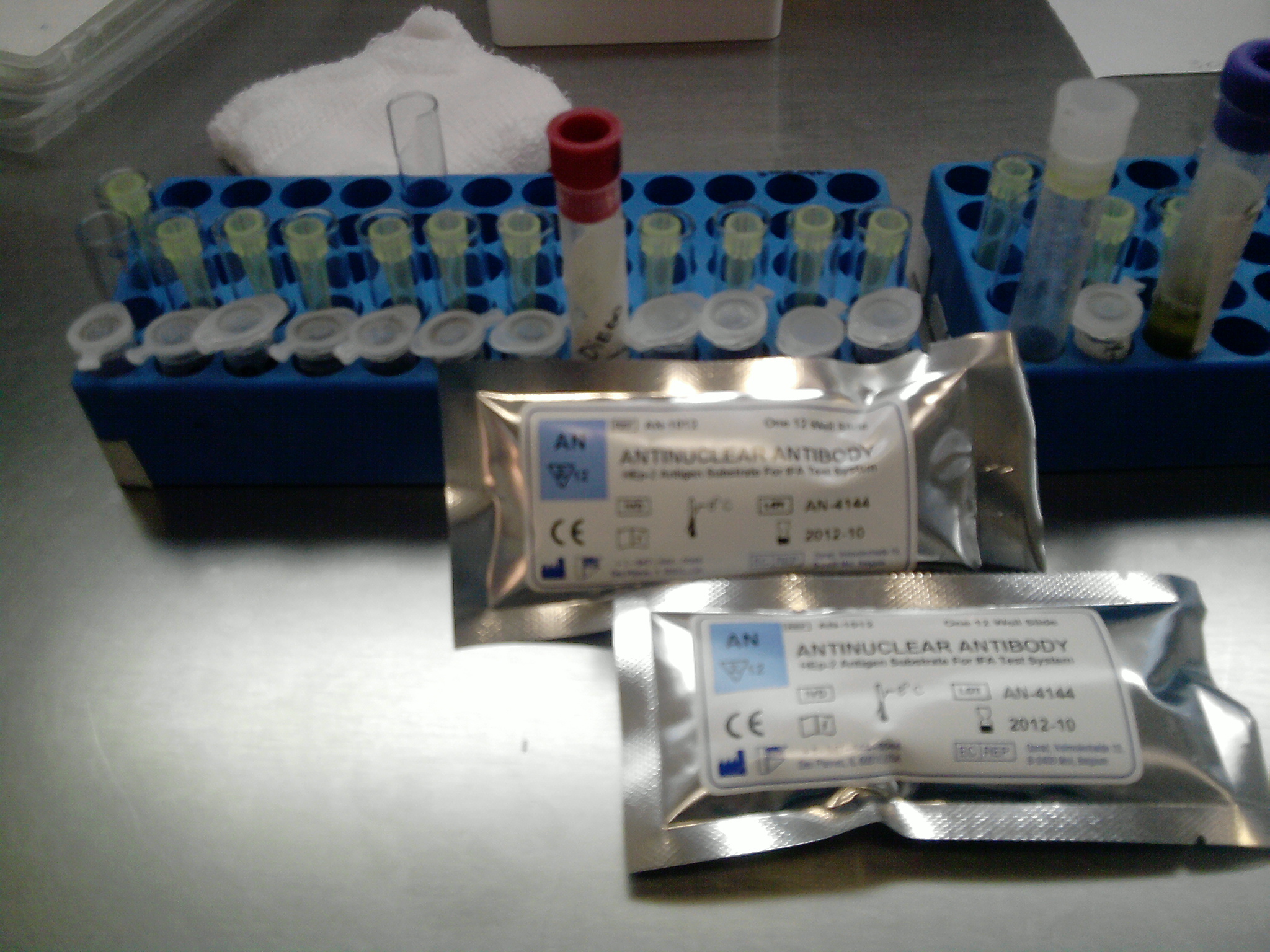 AntiNuclear Antibody (ANA) Test