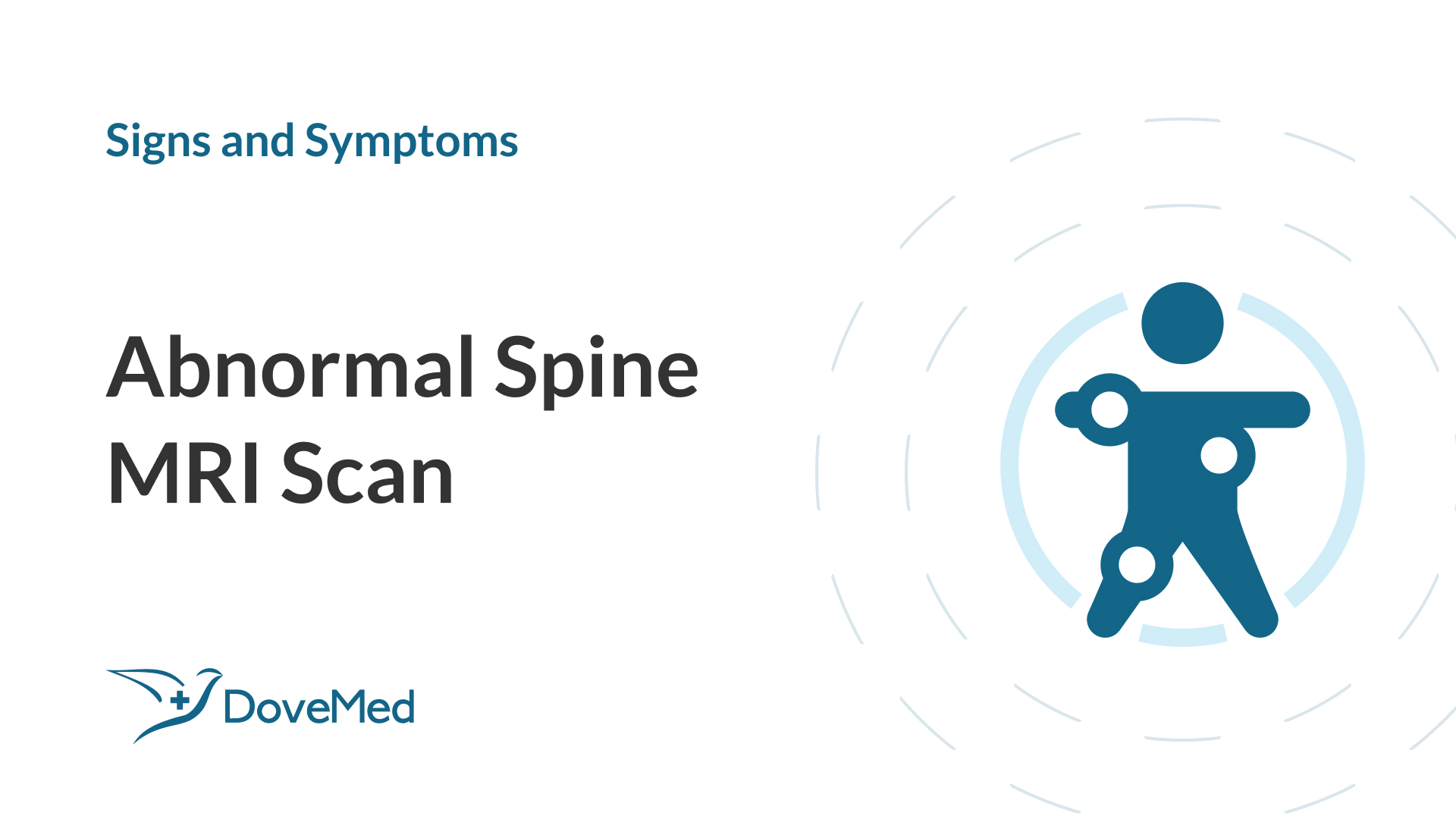 abnormal-spine-mri-scan