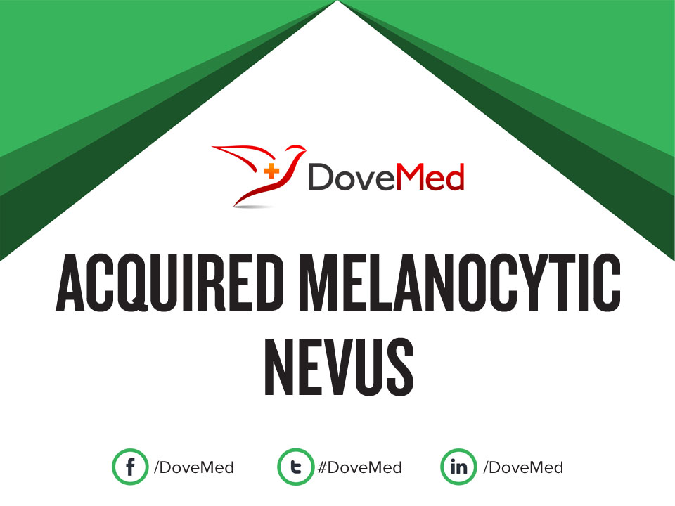 acquired melanocytic nevus