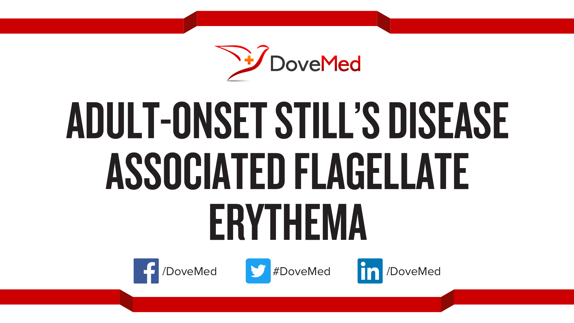 AdultOnset Still’s Disease Associated Flagellate Erythema