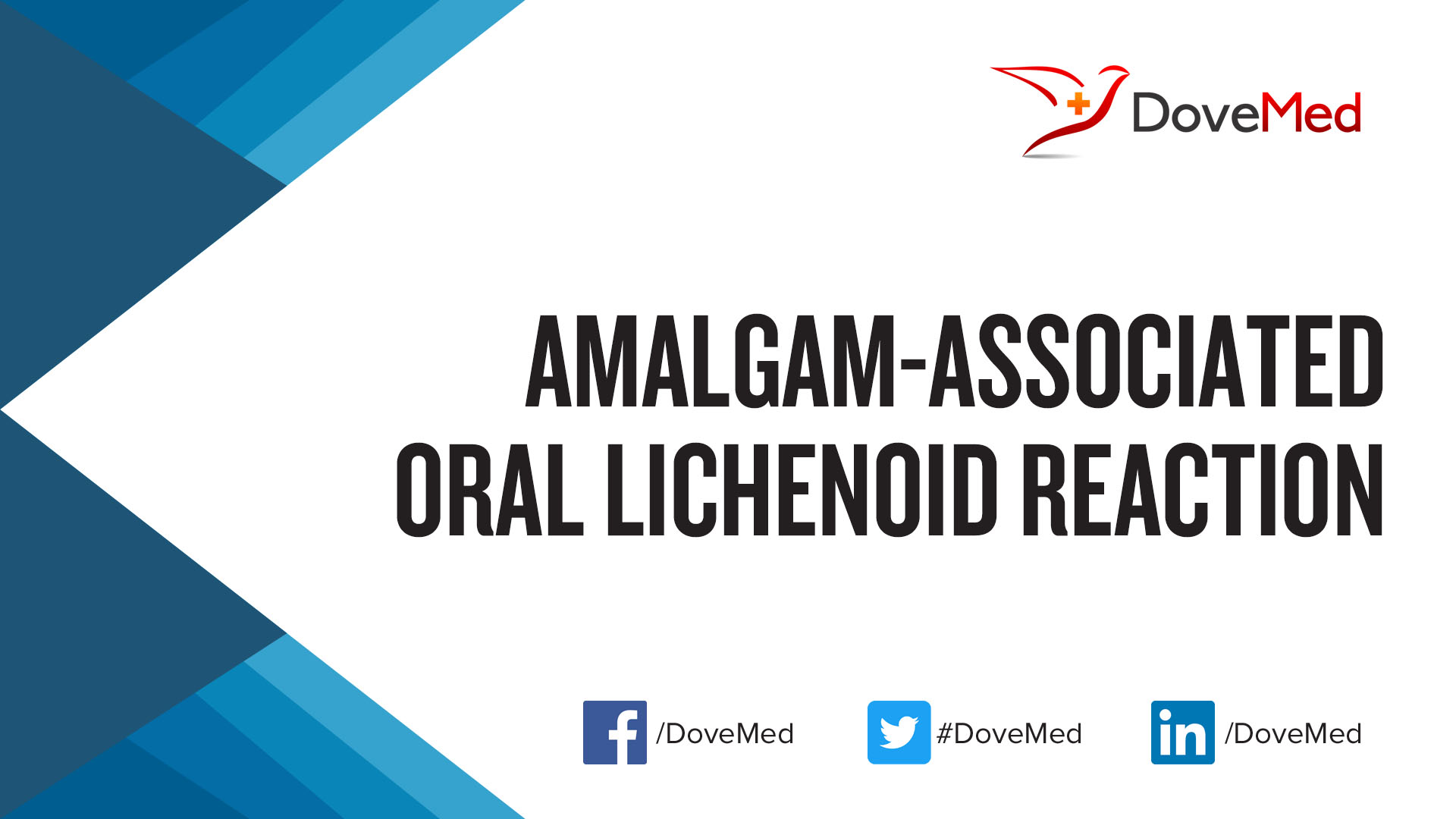 AmalgamAssociated Oral Lichenoid Reaction