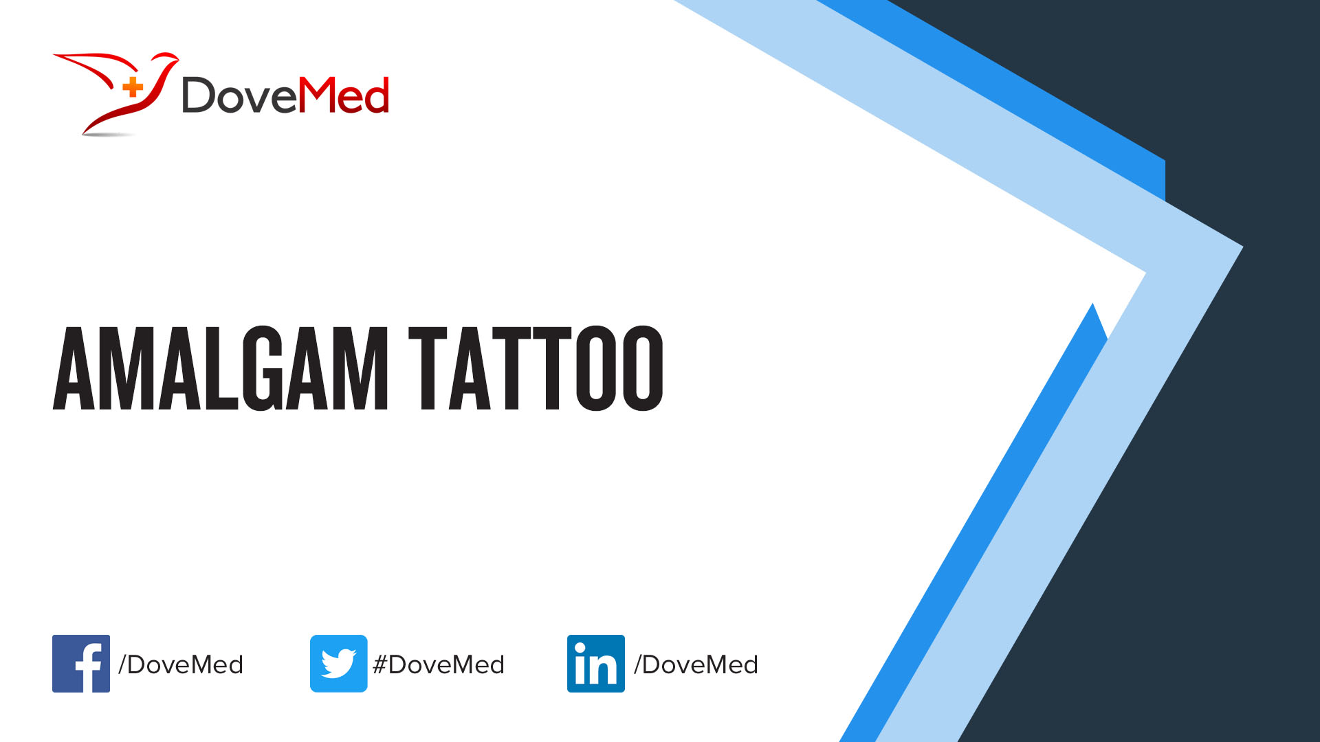 Amalgam Tattoo